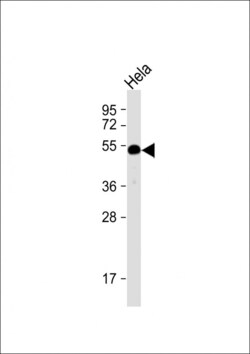 Invitrogen HTRA1 Polyclonal Antibody 200 μL; Unconjugated:Antibodies,