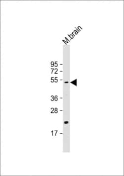 Invitrogen HTRA1 Polyclonal Antibody 200 μL; Unconjugated:Antibodies,