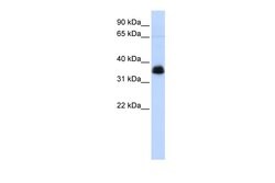 Invitrogen AIP Polyclonal Antibody 100 &mu;L; Unconjugated:Antibodies,