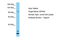 Invitrogen EphA5 Polyclonal Antibody 100 &mu;L; Unconjugated:Antibodies,