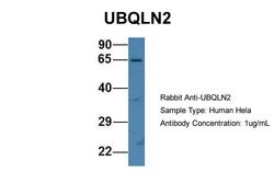 Invitrogen Ubiquilin 2 Polyclonal Antibody 100 μL; Unconjugated:Antibodies,