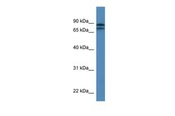 Invitrogen KLHL22 Polyclonal Antibody 100 μL; Unconjugated:Antibodies,