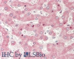 Invitrogen Adiponectin Receptor 2 Polyclonal Antibody 100 μL; Unconjugated:Antibodies,