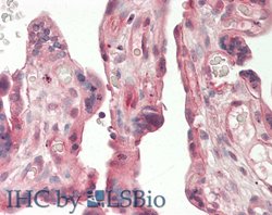 Invitrogen Adiponectin Receptor 2 Polyclonal Antibody 100 μL; Unconjugated:Antibodies,