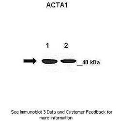 Invitrogen ACTA1 Polyclonal Antibody 100 &mu;L; Unconjugated:Antibodies,