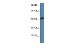 Invitrogen ACTA1 Polyclonal Antibody 100 &mu;L; Unconjugated:Antibodies,