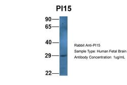 Invitrogen PI15 Polyclonal Antibody 100 &mu;L; Unconjugated:Antibodies,