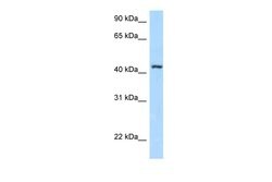Invitrogen FBXL8 Polyclonal Antibody 100 μL; Unconjugated:Antibodies,