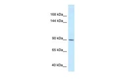 Invitrogen DACT1 Polyclonal Antibody 100 &mu;L | Buy Online | Invitrogen&trade; | Fisher Scientific
