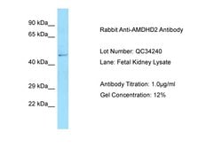 Invitrogen AMDHD2 Polyclonal Antibody 100 &mu;L | Buy Online | Invitrogen&trade; | Fisher Scientific