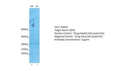 Invitrogen SDHC Polyclonal Antibody 100 μL; Unconjugated:Antibodies,