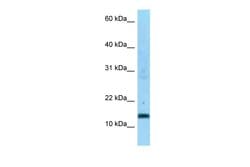 Invitrogen SDHC Polyclonal Antibody 100 μL; Unconjugated:Antibodies,