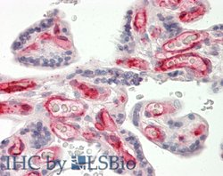 Invitrogen FCGR2B Polyclonal Antibody 100 &mu;L; Unconjugated:Antibodies,
