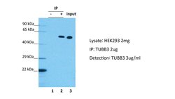Invitrogen beta-3 Tubulin Polyclonal Antibody 100 &mu;L; Unconjugated:Antibodies,
