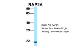 Invitrogen RAP2A Polyclonal Antibody 100 &mu;L | Buy Online | Invitrogen&trade; | Fisher Scientific