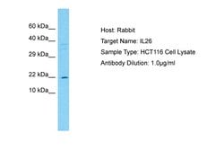 Invitrogen IL-26 Polyclonal Antibody 100 &mu;L; Unconjugated:Antibodies,
