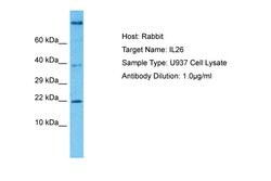 Invitrogen IL-26 Polyclonal Antibody 100 &mu;L; Unconjugated:Antibodies,