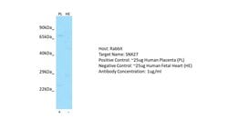 Invitrogen SNX27 Polyclonal Antibody 100 μL; Unconjugated:Antibodies,
