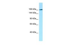 Invitrogen MAST1 Polyclonal Antibody 100 μL; Unconjugated:Antibodies,