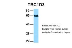 Invitrogen TBC1D3 Polyclonal Antibody 100 &mu;L; Unconjugated:Antibodies,