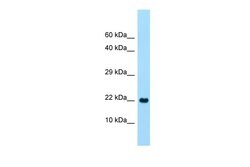 CLEC2A Polyclonal Antibody:Antibodies, Polyclonal