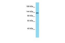 Invitrogen LMTK3 Polyclonal Antibody 100 &mu;L; Unconjugated:Antistoffer