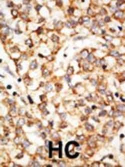Invitrogen APOBEC1 Polyclonal Antibody 400 &mu;L; Unconjugated:Antibodies,