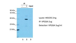 Invitrogen VPS26A Polyclonal Antibody 100 &mu;L; Unconjugated:Antibodies,
