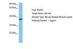 Invitrogen AKR1B8 Polyclonal Antibody 100 &mu;L; Unconjugated:Antibodies,