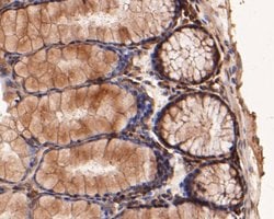 Invitrogen BCL2L15 Polyclonal Antibody 100 &mu;L; Unconjugated:Antibodies,