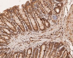 Invitrogen BCL2L15 Polyclonal Antibody 100 &mu;L; Unconjugated:Antibodies,