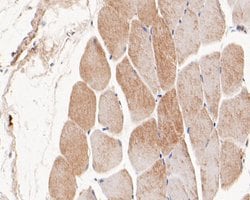 Invitrogen Syntrophin alpha-1 Polyclonal Antibody 100 &mu;L | Buy Online | Invitrogen&trade; | Fisher Scientific