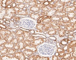 Invitrogen ZACN Polyclonal Antibody 100 &mu;L | Buy Online | Invitrogen&trade; | Fisher Scientific