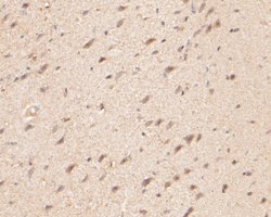 Invitrogen ZACN Polyclonal Antibody 100 &mu;L | Buy Online | Invitrogen&trade; | Fisher Scientific