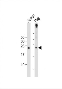 Invitrogen APOBEC3A Polyclonal Antibody 200 &mu;L; Unconjugated:Anticuerpos