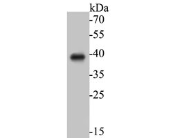 Invitrogen ADT2 Polyclonal Antibody 100 &mu;L; Unconjugated:Antibodies,