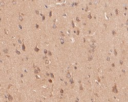 Invitrogen Kv2.2 Polyclonal Antibody 100 &mu;L; Unconjugated:Antibodies,