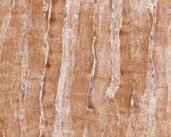 Invitrogen Kv2.2 Polyclonal Antibody 100 &mu;L; Unconjugated:Antibodies,