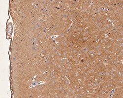Invitrogen GABRA1 Polyclonal Antibody 100 &mu;L; Unconjugated:Antibodies,