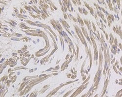 Invitrogen IL8 Polyclonal Antibody 100 &mu;L; Unconjugated:Antibodies,