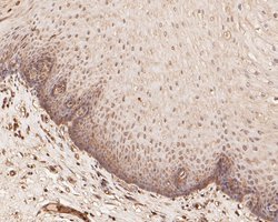 Invitrogen ZHX2 Polyclonal Antibody 100 &mu;L; Unconjugated:Antibodies,