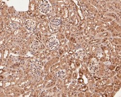 Invitrogen ZHX2 Polyclonal Antibody 100 &mu;L; Unconjugated:Antibodies,