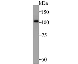 Invitrogen ZHX2 Polyclonal Antibody 100 &mu;L; Unconjugated:Antibodies,