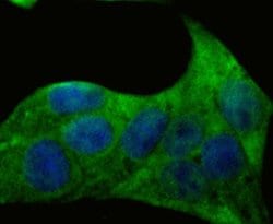 Invitrogen Desmoglein 3 Polyclonal Antibody 100 &mu;L; Unconjugated:Antibodies,
