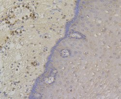 Invitrogen Desmoglein 3 Polyclonal Antibody 100 &mu;L; Unconjugated:Antibodies,