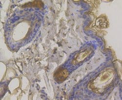 Invitrogen Desmoglein 3 Polyclonal Antibody 100 &mu;L; Unconjugated:Antibodies,