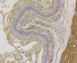 Invitrogen Desmoglein 3 Polyclonal Antibody 100 &mu;L; Unconjugated:Antibodies,