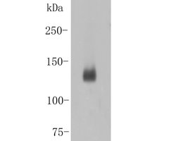 Invitrogen Desmoglein 3 Polyclonal Antibody 100 &mu;L; Unconjugated:Antibodies,