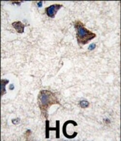 Invitrogen CDH4 Polyclonal Antibody 400 &mu;L | Buy Online | Invitrogen&trade; | Fisher Scientific