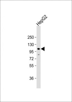 Invitrogen CDH4 Polyclonal Antibody 400 &mu;L | Buy Online | Invitrogen&trade; | Fisher Scientific